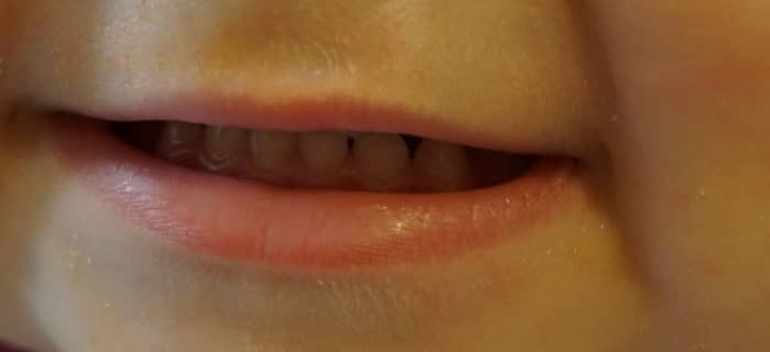 Kann ein Baby ohne Zähne essen?